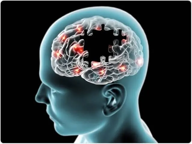 Alzheimer's/Dementia Help & Support Group